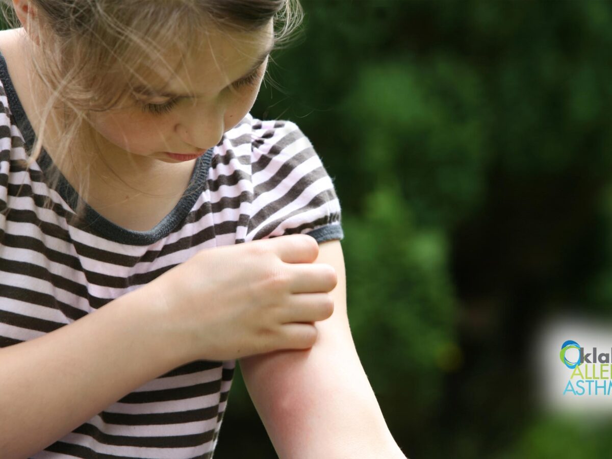 How to Spot and Prevent Common Bug Bites and Stings in Oklahoma