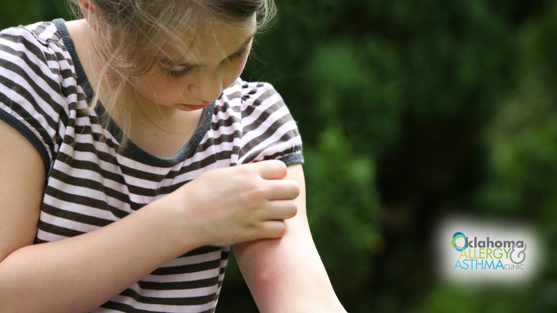 How to Spot and Prevent Common Bug Bites and Stings in Oklahoma
