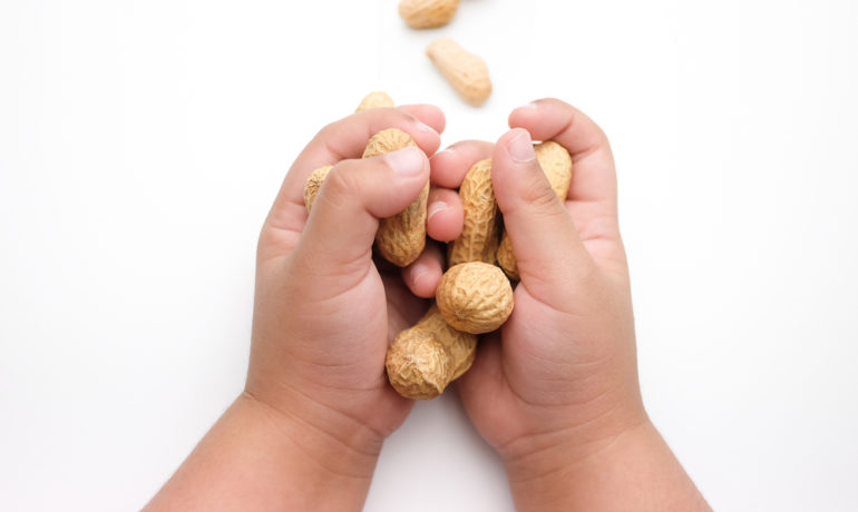 Peanut and Food Allergies